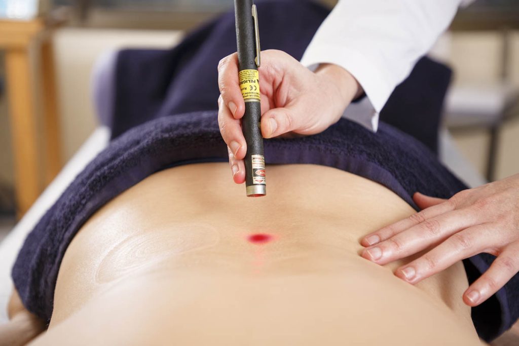 acupuntura sin agujas